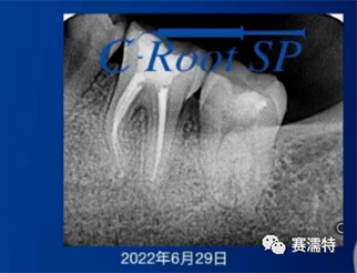 罗紫亮老师案例