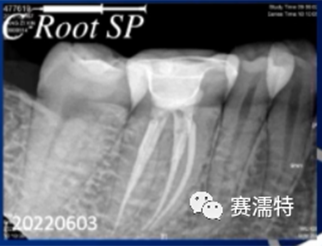 杨超老师案例