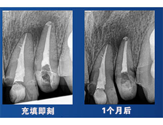 祝自洋老师案例