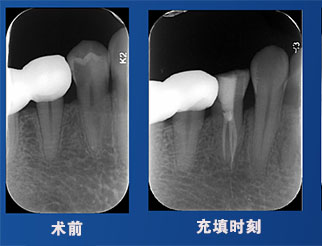 马月英老师案例